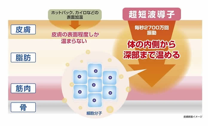 超短波治療器の図